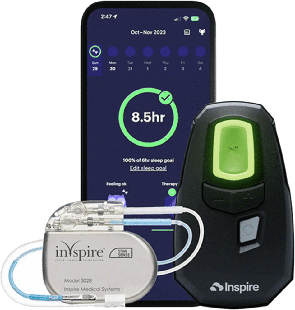The Inspire sleep apnea system: the implant, its remote and the companion app